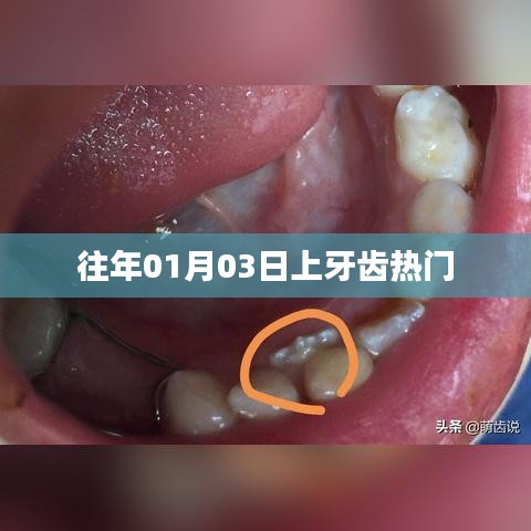 上牙齿热门背后的故事
