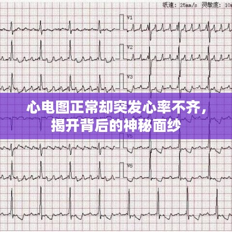 心电图正常却突发心率不齐，揭开背后的神秘面纱