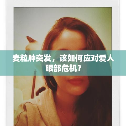 麦粒肿突发，该如何应对爱人眼部危机？