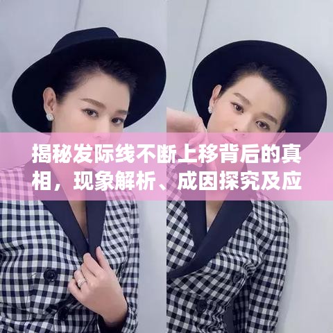 揭秘发际线不断上移背后的真相，现象解析、成因探究及应对妙招！